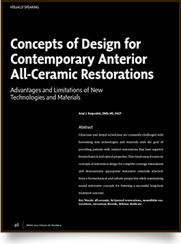 Concepts of Design for Contemporary Anterior All-Ceramic Restorations at Aesthetic Restorative & Implant Dentistry Northwest
