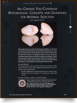 All-Ceramic Full-Coverage Restorations:Concepts and Guidelines for Material Selection article at Aesthetic Restorative & Implant Dentistry Northwest
