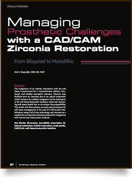 Managing Prosthetic Challenges with a CAD/CAM Zirconia Restoration article at Aesthetic Restorative & Implant Dentistry Northwest